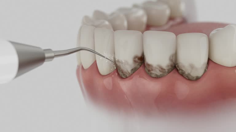 Reliable Dental Implants contractor in Ranchester, WY by Smile Center Dentistry